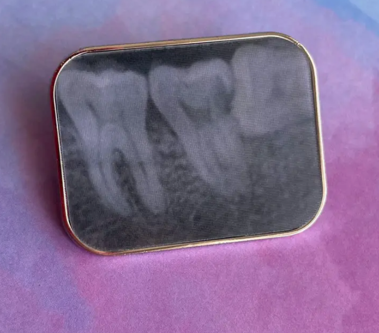 Dental Size 2 X-Ray Lenticular Pin (Rad Girl Creations)