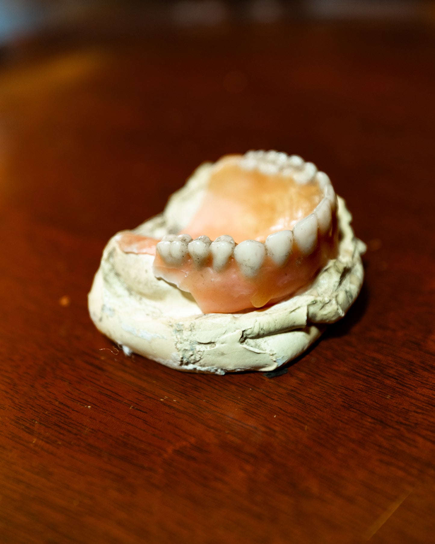 Dentures- Partial Top